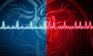 Comparação entre um coração normal e outro com fibrilação atrial